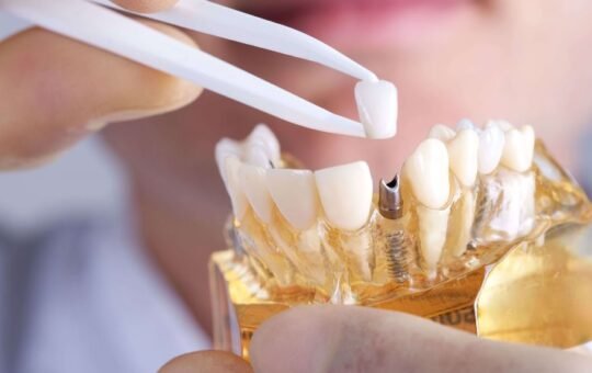 intrebari implant dentar